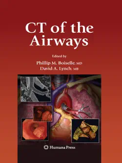 ct of the airways imagen de la portada del libro