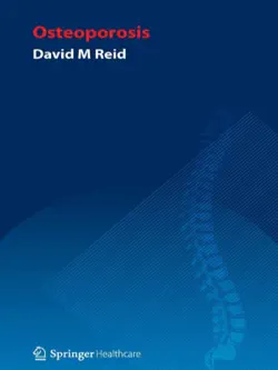handbook of osteoporosis book cover image