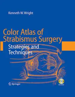 color atlas of strabismus surgery book cover image