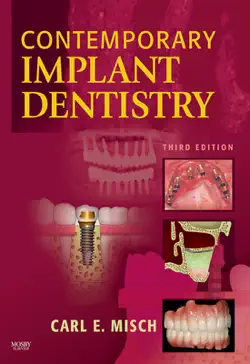 contemporary implant dentistry - e-book book cover image