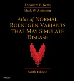atlas of normal roentgen variants that may simulate disease e-book book cover image
