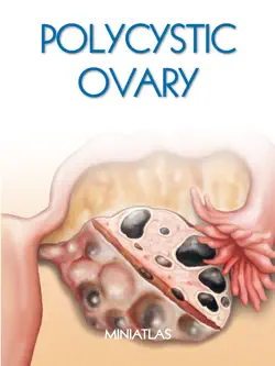 polycystic ovary miniatlas imagen de la portada del libro