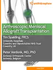 Arthroscopic Meniscal Allograft Transplantation sinopsis y comentarios