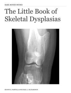 the little book of skeletal dysplasias book cover image
