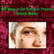 40 Ways to Get Rid of or Prevent Stretch Marks sinopsis y comentarios