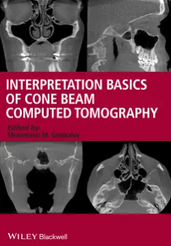 interpretation basics of cone beam computed tomography book cover image