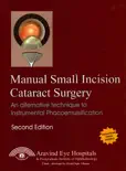 Manual Small Incision Cataract Surgery reviews
