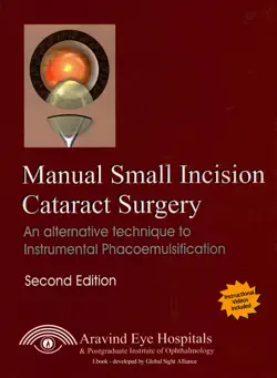 manual small incision cataract surgery imagen de la portada del libro