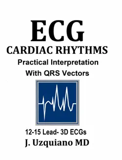 ecg cardiac rhythm book cover image