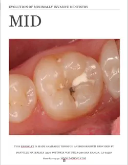 minimally invasive dentistry-mid book cover image