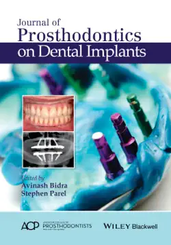journal of prosthodontics on dental implants book cover image