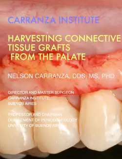 harvesting connective tissue grafts imagen de la portada del libro