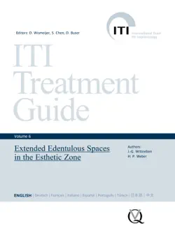extended edentulous spaces in the esthetic zone book cover image