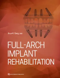 full-arch implant rehabilitation book cover image