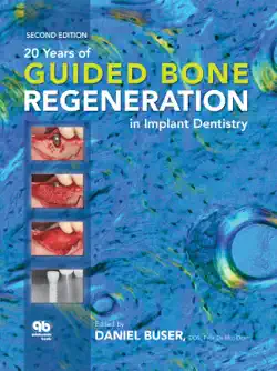 20 years of guided bone regeneration in implant dentistry book cover image