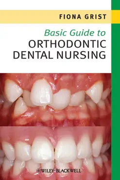 basic guide to orthodontic dental nursing book cover image