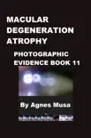 Macular Degeneration Atrophy, Photographic Evidence Book 11 synopsis, comments