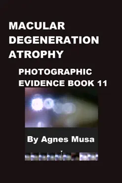 macular degeneration atrophy, photographic evidence book 11 book cover image