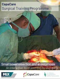 capacare - small bowel resection and anastomosis book cover image