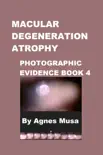 Macular Degeneration Atrophy, Photographic Evidence Book 4 synopsis, comments