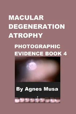 macular degeneration atrophy, photographic evidence book 4 book cover image