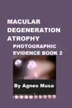 Macular Degeneration Atrophy, Photographic Evidence Book 2 synopsis, comments