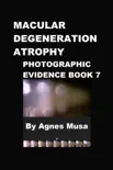 Macular Degeneration Atrophy, Photographic Evidence Book 7 synopsis, comments