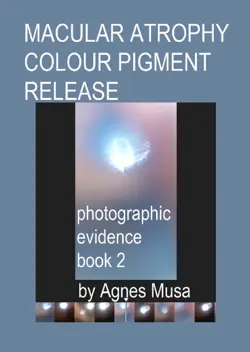 macular atrophy colour pigment release, photographic evidence book 2 book cover image