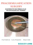 Phacoemulsification Surgery synopsis, comments