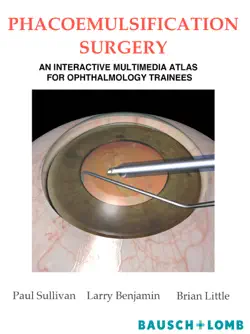 phacoemulsification surgery book cover image