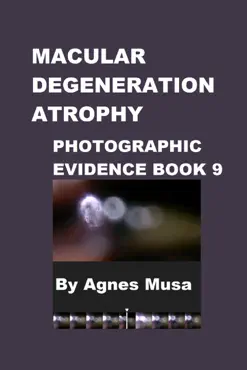 macular degeneration atrophy, photographic evidence book 9 book cover image