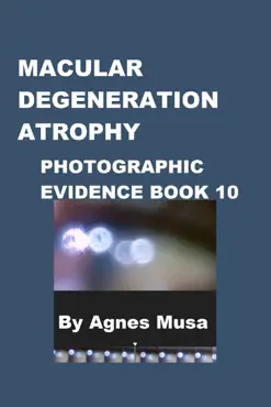 macular degeneration atrophy, photographic evidence book 10 book cover image