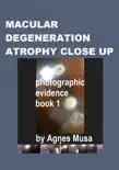 Macular Degeneration Atrophy Close Up, Photographic Evidence Book 1 synopsis, comments
