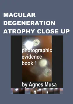 macular degeneration atrophy close up, photographic evidence book 1 book cover image