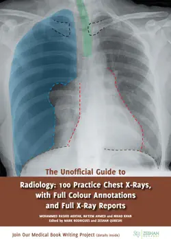 the unofficial guide to radiology book cover image