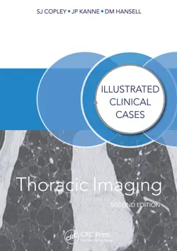 thoracic imaging book cover image