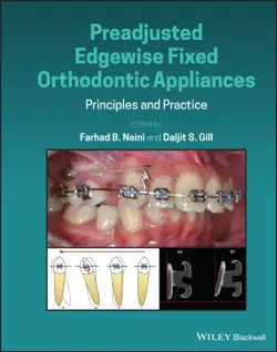 preadjusted edgewise fixed orthodontic appliances book cover image