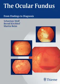 the ocular fundus book cover image