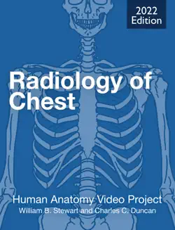 radiology of chest book cover image
