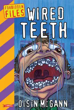 wired teeth book cover image