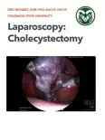Laparoscopy Cholecystectomy reviews
