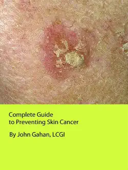 complete guide to preventing skin cancer book cover image