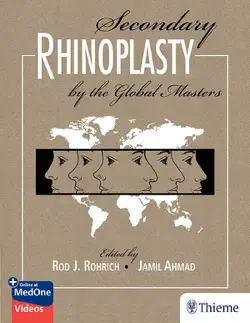 secondary rhinoplasty by the global masters book cover image