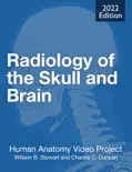Radiology of the Skull and Brain reviews