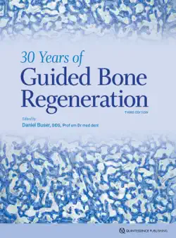 30 years of guided bone regeneration book cover image