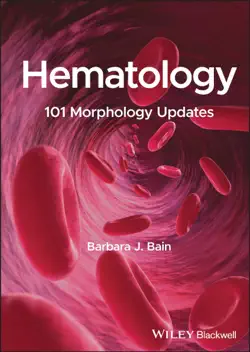 hematology book cover image