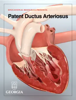 patent ductus arteriosus book cover image
