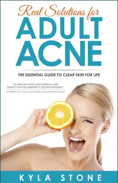 real solutions for adult acne book cover image