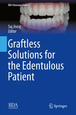 graftless solutions for the edentulous patient book cover image