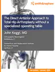 The Direct Anterior Approach to Total Hip Arthroplasty without a specialized operating table synopsis, comments